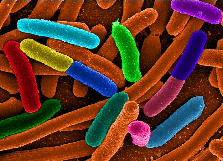 Electron miscrope photo E. coli